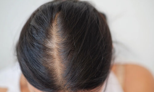 Crown Volumiser / Replacement Online Course