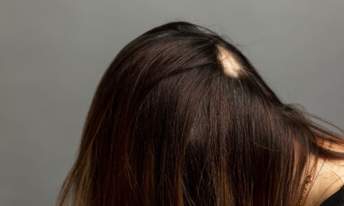 Full Head Mesh Integration And Crown Volumiser Online Course